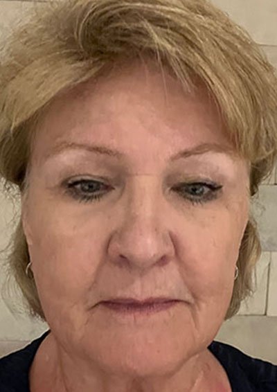 Barbara H.
