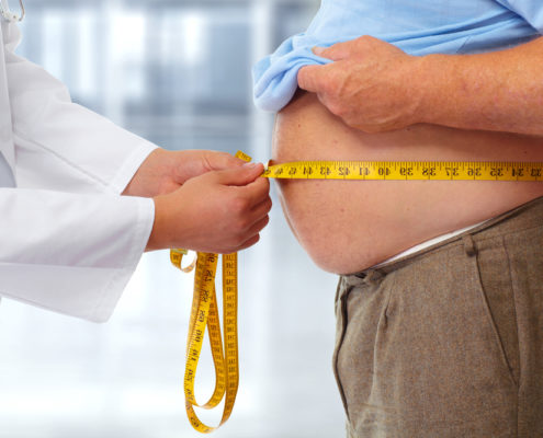 An image of a doctor measuring an obese man's bulging stomach.