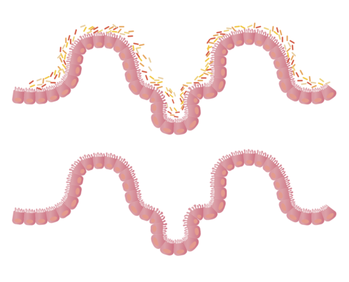 An image of two intestinal linings, one healthy and one with gut dysbiosis.