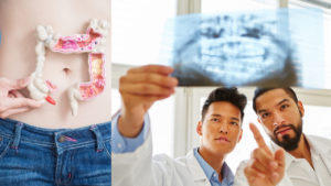 An image of 2 doctors looking at an x-ray, and a woman holding a model of colon cancer in front of her stomach. 