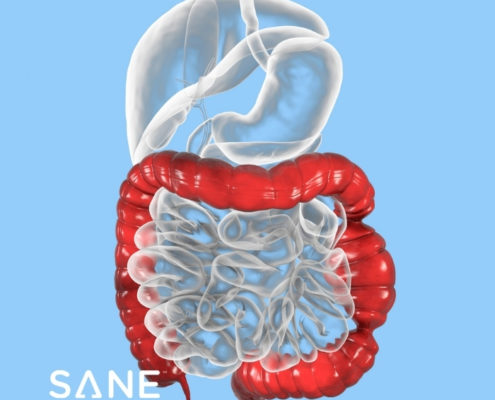 A 3D illustration showing the spasms and distortion of large intestine common in IBS.