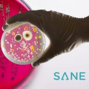 An image of a gloved hand holding a petri dish of bacteria.