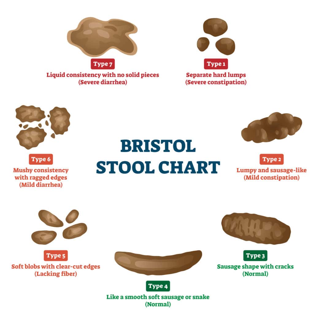 An illustration of the Bristol Stool Chart categorizing different shapes and consistencies of stool with text below. 